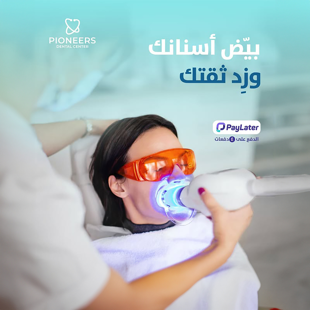 تبييض الأسنان