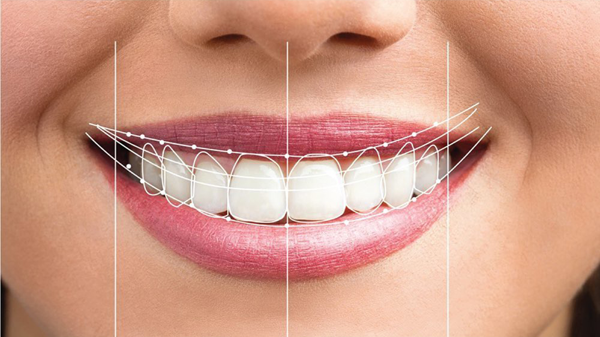 ابتسامة مثالية تبدأ من هنا