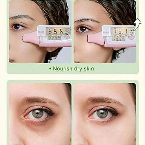 Under eye Aloe Gel Eye Mask, for dark circles and puffiness, dry eyes, brightening, korean skin care