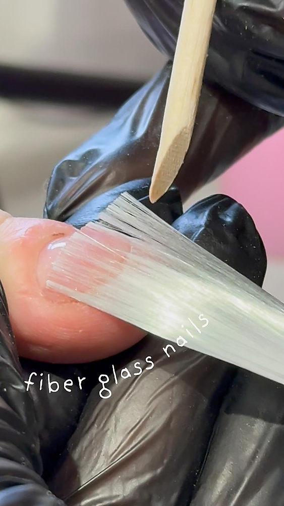 Fiber glass nails