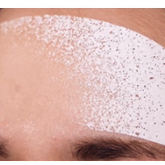 Dermarssance highprime collagen film cheek