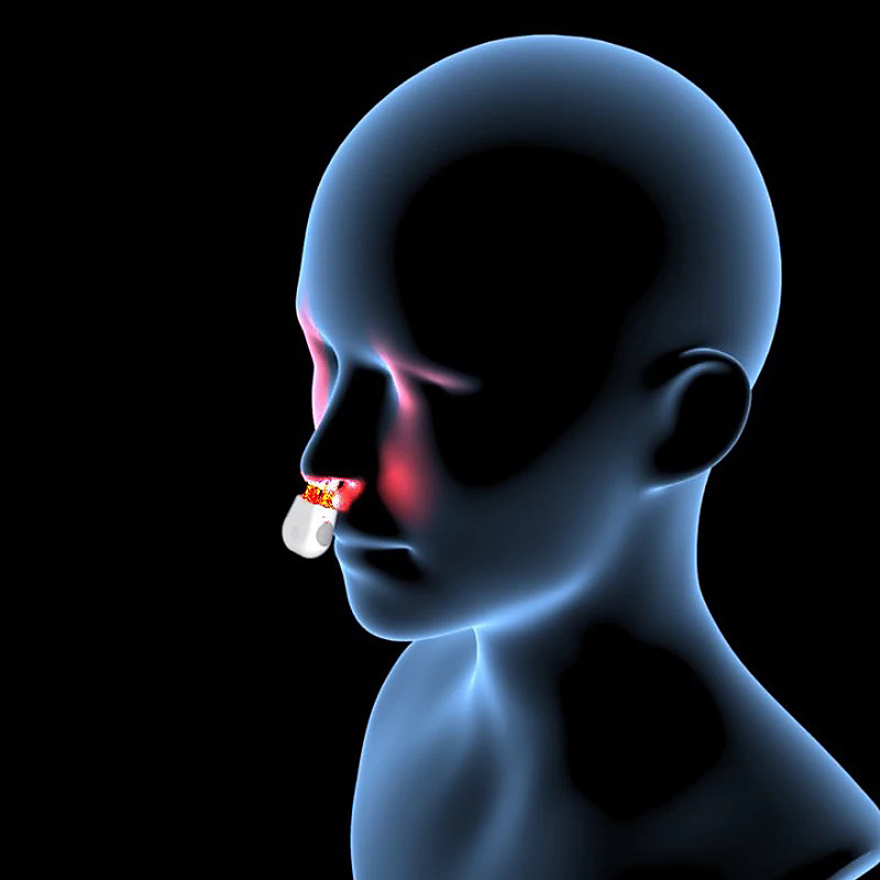 الجهاز الطبي لعلاج التهاب الأنف التحسسي-Ho Physio