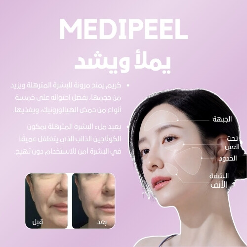 كريم إيزي فيلر