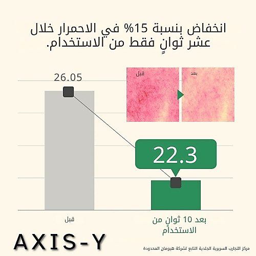 تونر مصحح للبقع الداكنة ومُعزز للإشراقة، 125 مل