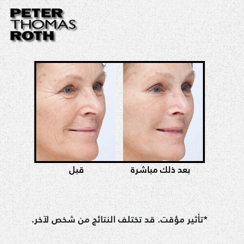 مشد الوجه الفوري المؤقت Instant FIRMx