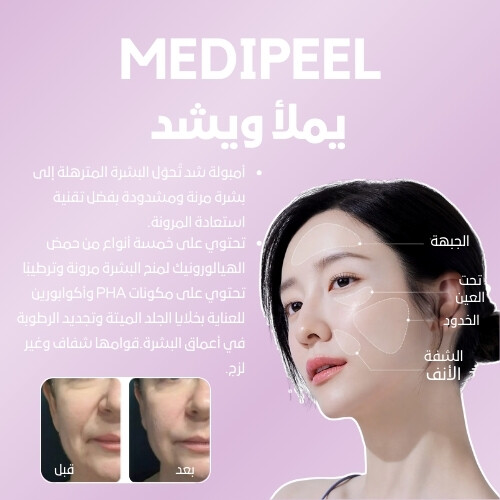 أمبولة إيزي فيلر