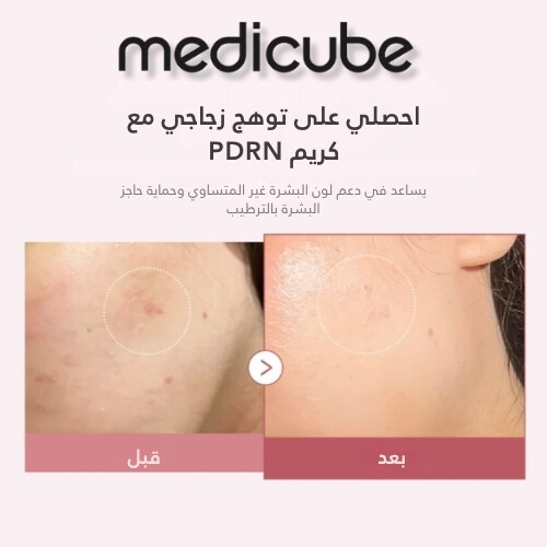 كريم PDRN الوردي المرطب بحمض الهيالورونيك 50 مل