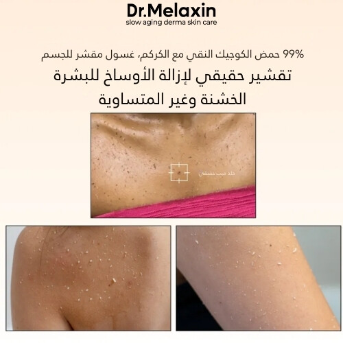 بخاخ التقشير بحمض الكوجيك والكركم من بيل شوت