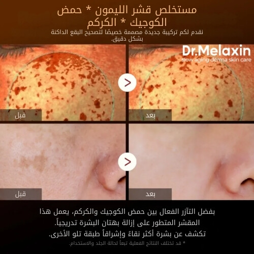 سيروم التقشير بحمض الكوجيك والكركم من بيل شوت