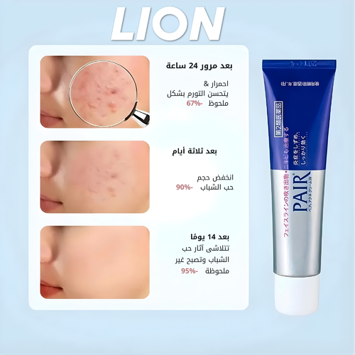 كريم ليون لعلاج حب الشباب 24 غرام