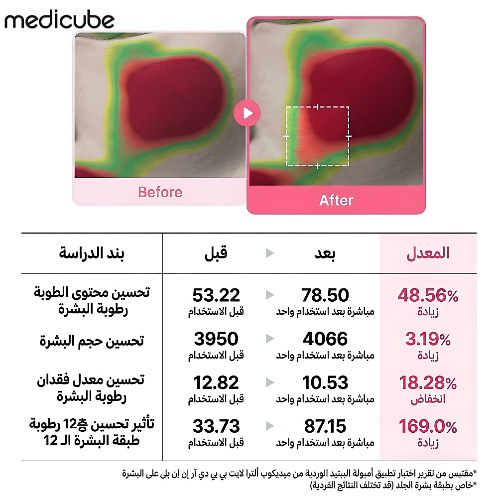 سيروم الببتيد الوردي بي دي ار ان الخفيف 30مل