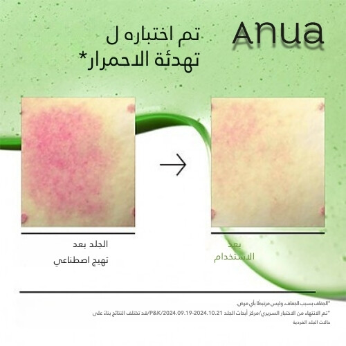 مصل مهدئ للاحمرار بحمض الأزيليك 10 هيالورون 30 مل