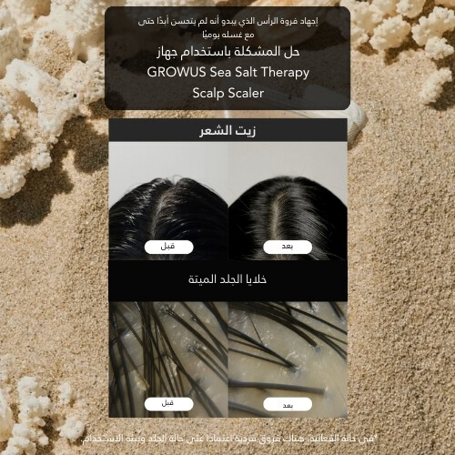 جرووس ملح البحر المعالج لفروة الرأس 250 جرام