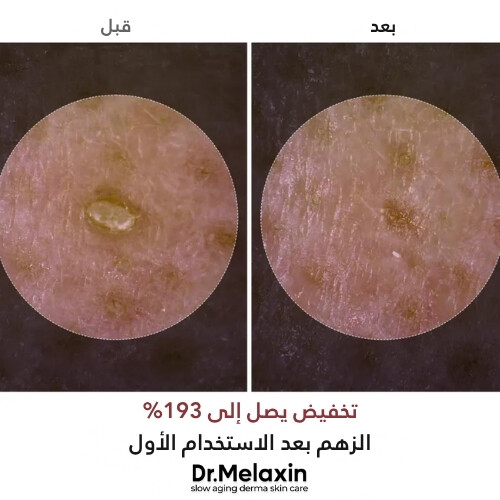 أمبولة تقشير  بالأرز الأبيض ٨٠ مل