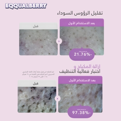 زيت الأرز الأرجواني لتنظيف المسام وتنعيمها