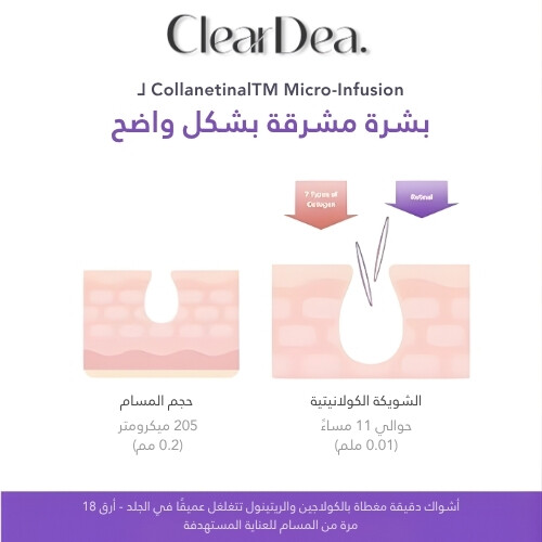 حقنة ميوسين كولانيتينال للتجاعيد العميقة 4 مل (5 قطع)