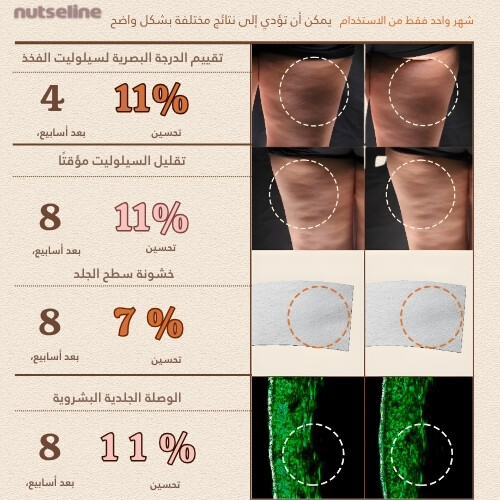 لوشن الجسم أروما نوت سليم فيت 200 مل