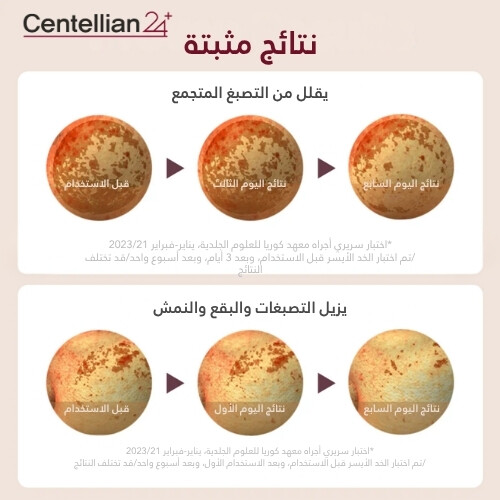 ضمادات أمبولة Madeca Mela Capture 60 قطعة