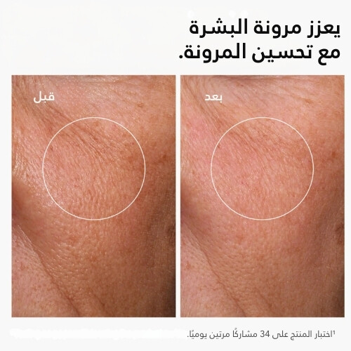 حمض الهيالورونيك 2% + B5 (مع السيراميدات)