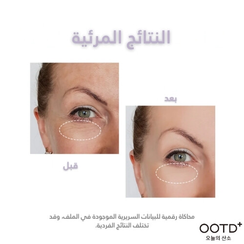 كريم العين الليلي مساءً