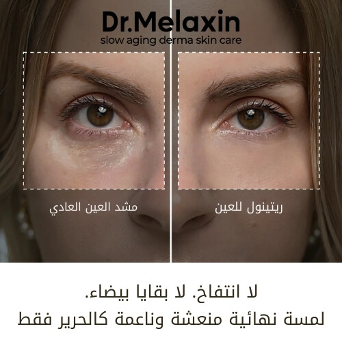 كريم إيفالت ريتينول للهالات السوداء 10 غرام