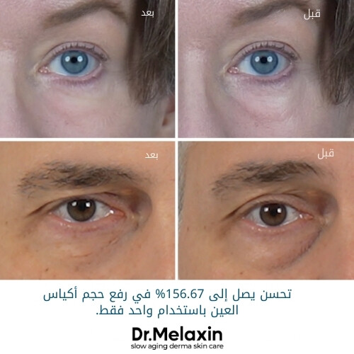 كريم إيفالت للهالات السوداء 10 غرام