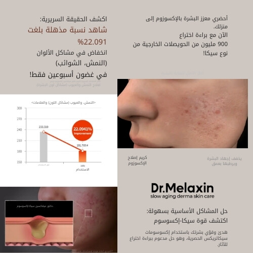 كريم إصلاح الإكسوسوم 50 مل