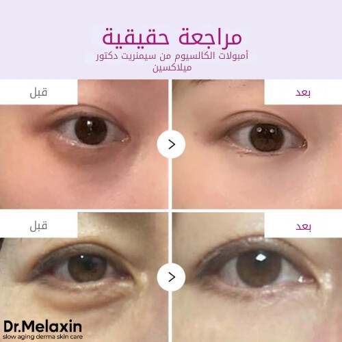 أمبولات سيمينريت كالسيوم مكثفة بلس 30 مل