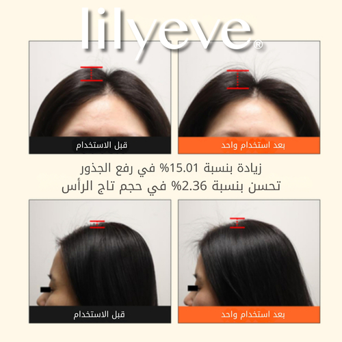 شامبو ليلييف جرو تيرن ثلاثي الأبعاد لزيادة كثافة الشعر 200 مل