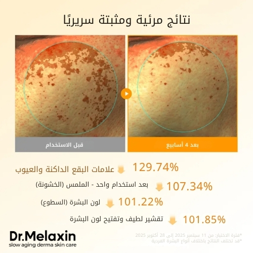 وسادات تونر بالكركم وحمض الكوجيك من تي إكس (70 وسادة)