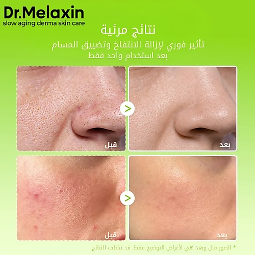 Cactox Pore Relief Jelly Serum Mist 80ml