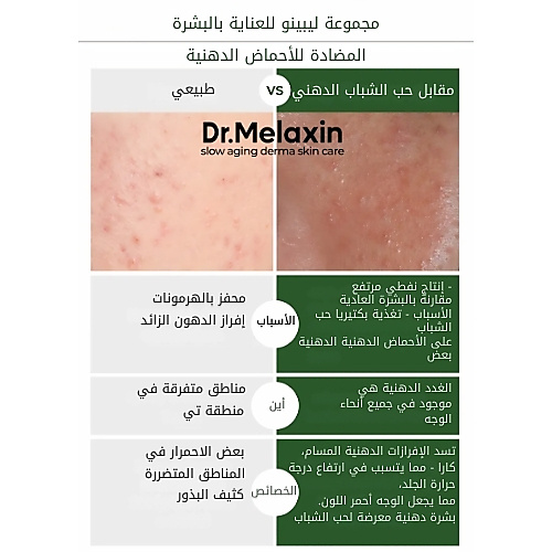 أمبولات زيت ليبينو المضاد للأحماض الدهنية 30 مل