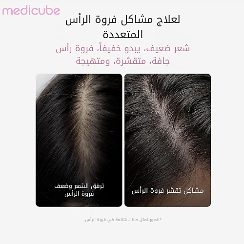 سيروم فروة الرأس روزيماري PDRN 20 مل