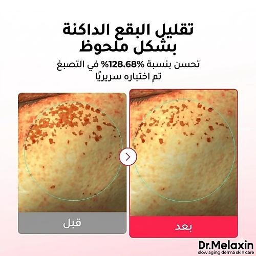 قناع TX Astaxanthin علاج البقع الداكنة 2 في1  (قطعة واحدة)