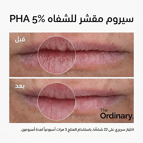 سيروم تقشير الشفاه PHA 5%