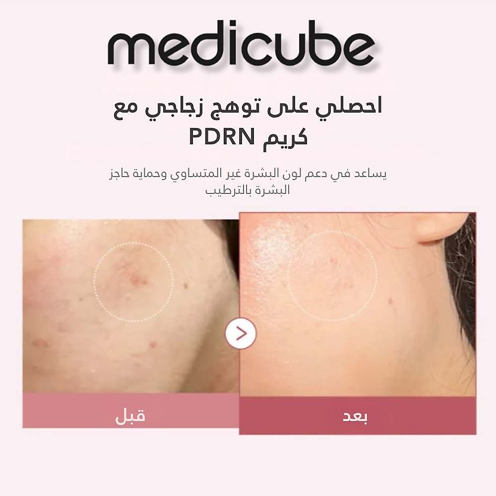 كريم PDRN الوردي المرطب بحمض الهيالورونيك 50 مل
