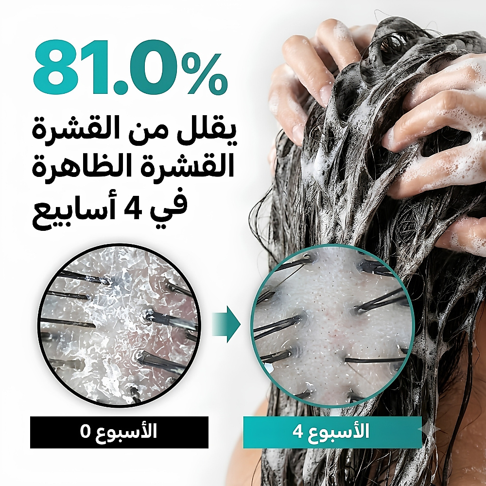 شامبو التنظيف العميق لفروة الرأس: تيرن سيكا بي دي آر إن ٥٠٠ غرام