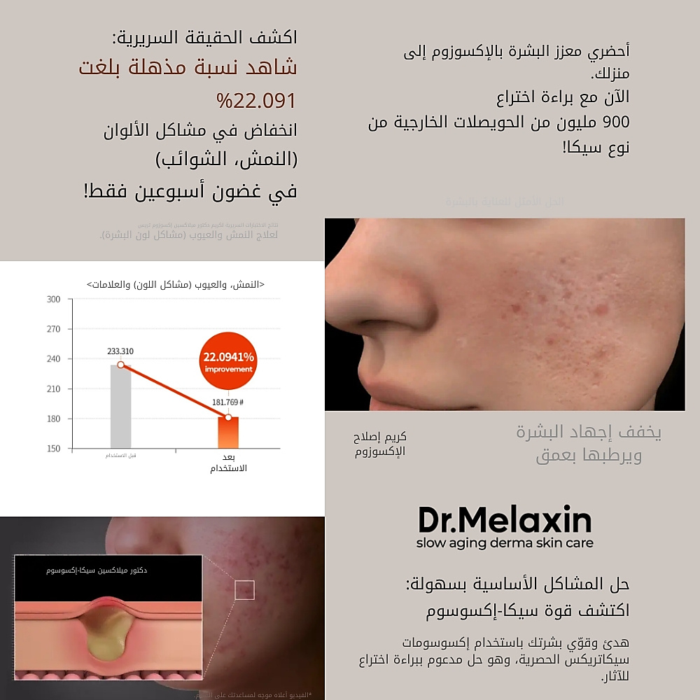 كريم إصلاح الإكسوسوم 50 مل