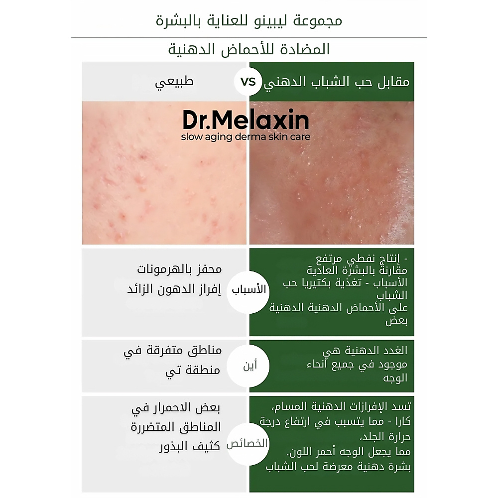 أمبولات زيت ليبينو المضاد للأحماض الدهنية 30 مل