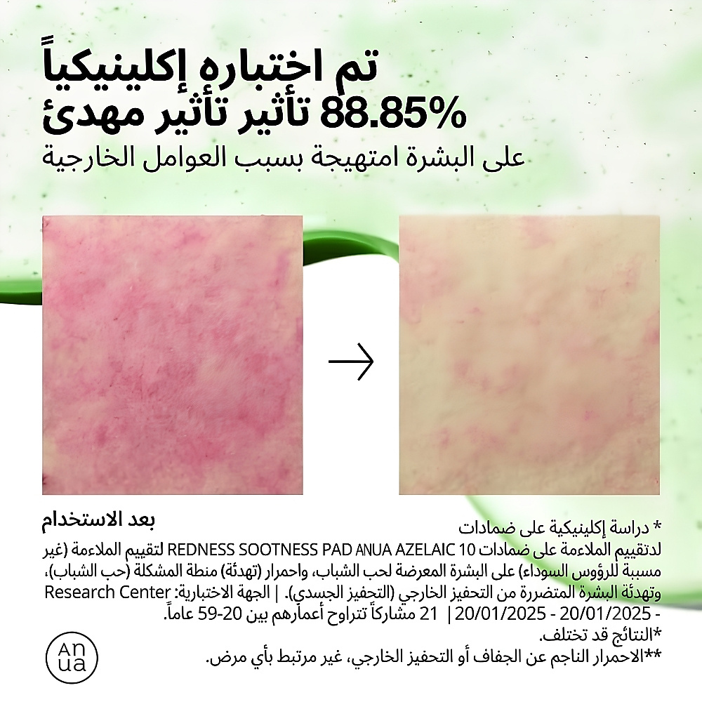 Azelaic Acid 10 Hyaluron Redness Soothing