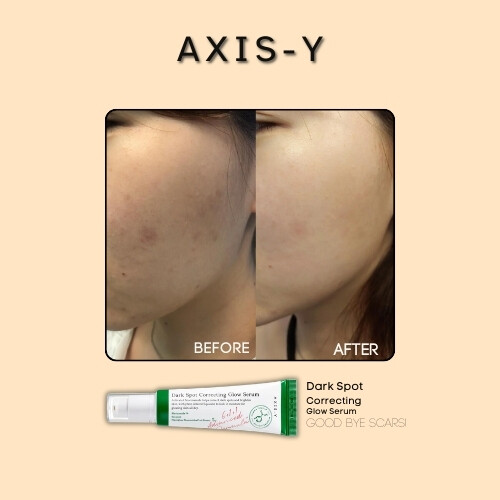 مصل التوهج لتصحيح البقع الداكنة