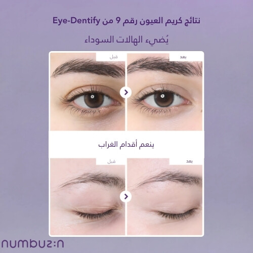 كريم العيون رقم 9 NAD+ ريتينول فوليومتوكس 10 مل