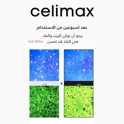 كريم مرطب للتحكم في الزيوت 80 مل