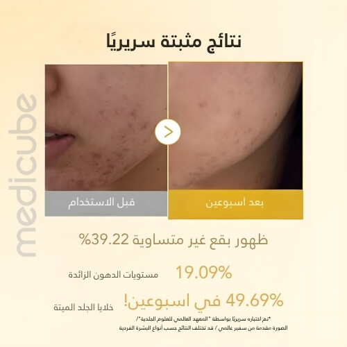 ضمادات الكركم وحمض الكوجيك (70 قطعة)