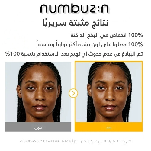 أمبولة مُركّزة مُتقدّمة من الجلوتاثيون TXA رقم 5 للبقع الداكنة