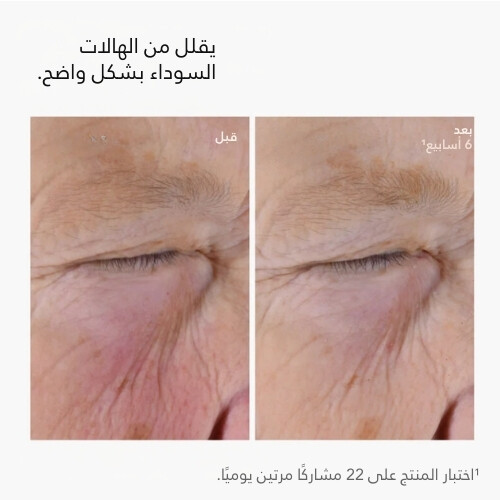 محلول الكافيين 5% + EGCG