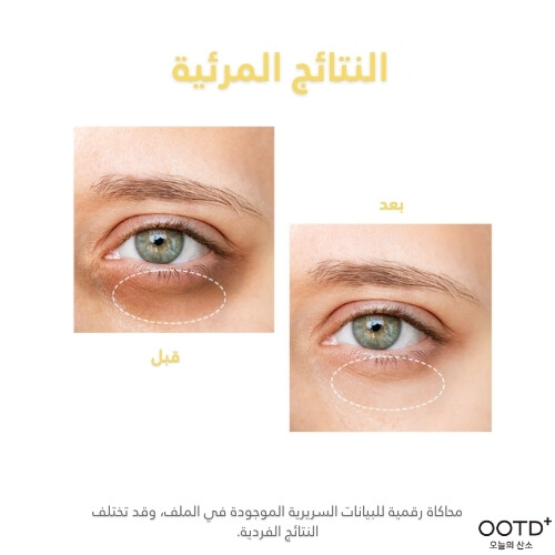 سيروم الهالات السوداء حول العين