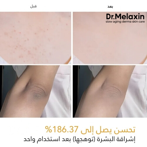 بخاخ التقشير بحمض الكوجيك والكركم من بيل شوت