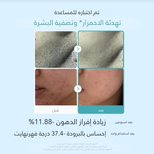 تونر شفاف يحتوي على حمض الأزيليك والنياسيناميد، 250 مل