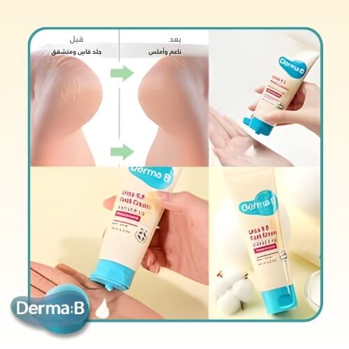 كريم للقدمين يحتوي على 9.8% يوريا، 80 مل